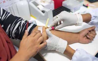 Cómo prepararse para un Trasplante